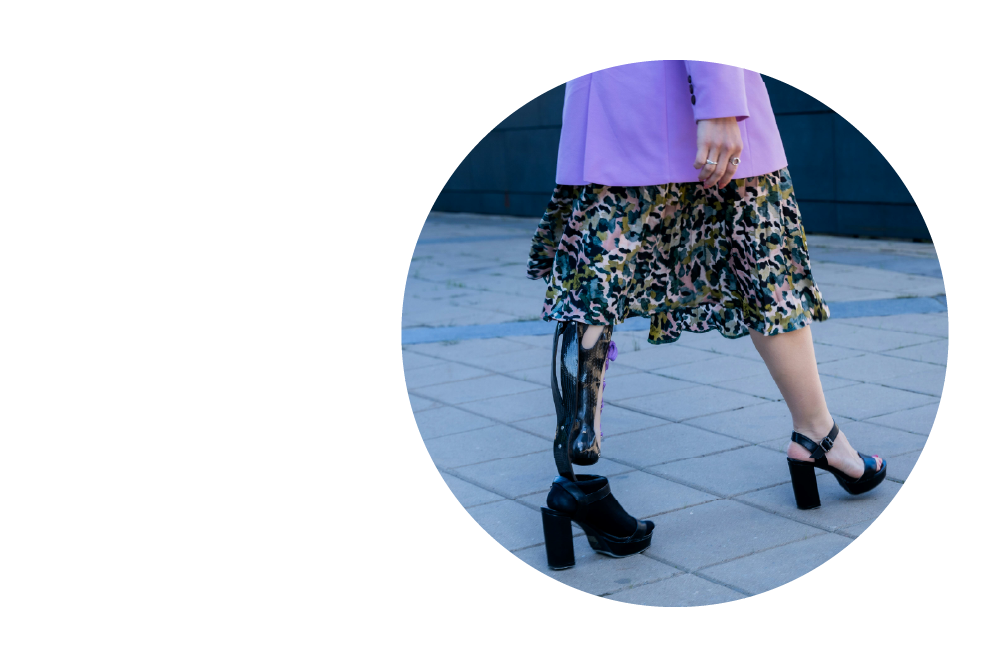 A lower body shot of a person walking on a tiled surface. The person is wearing a colourful patterned skirt, purple jacket, and black platform shoes. One leg is a prosthetic limb