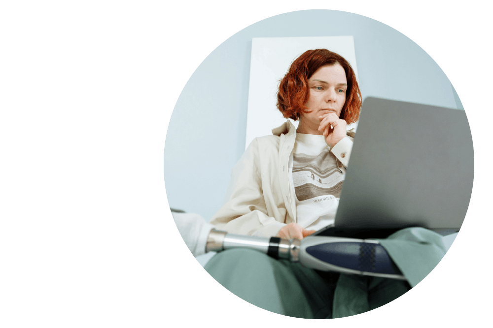 a person with a prosthetic limb, sitting with their legs crossed and an open laptop computer in their lap. They have one hand raised to their chin with a thoughtful expression.